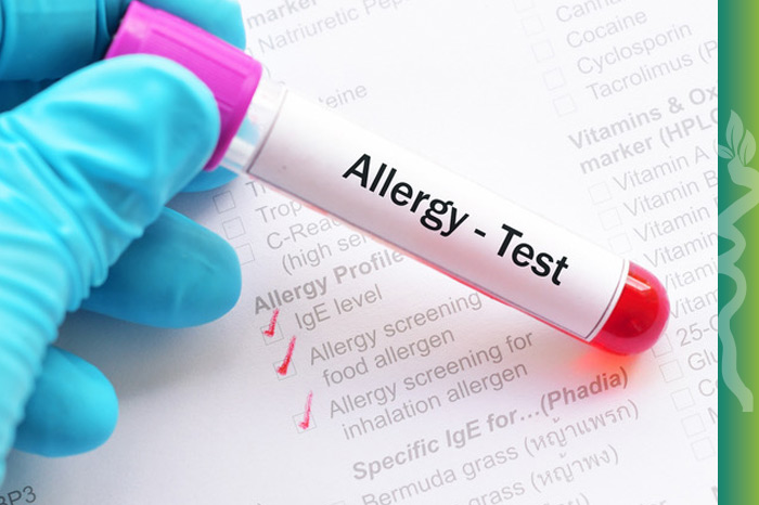 Allergien - Homöopathie - Gesundheit